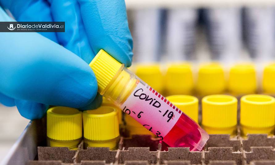Critican altos precios de pruebas de COVID-19 en clínicas privadas