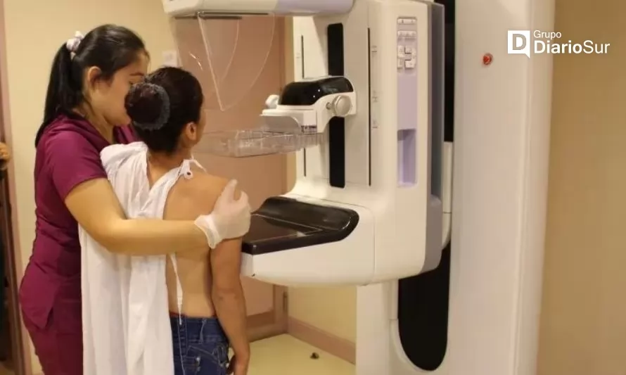 A ley proyecto que permite realizar mamografía sin orden médica